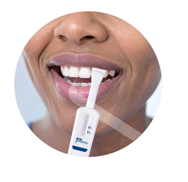 Image of OraQuick Self-Test Device being used